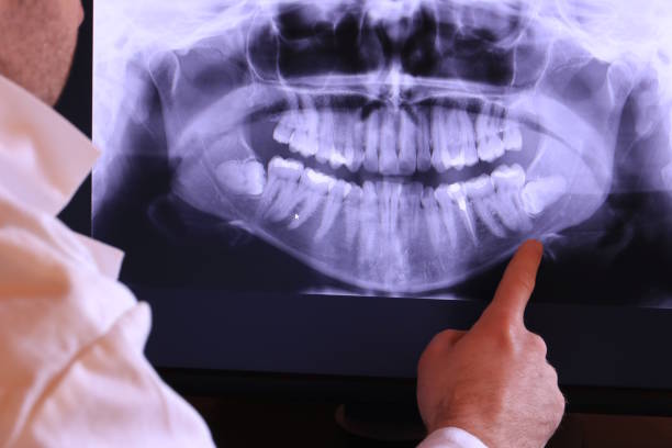 Best Pediatric Emergency Dentist in Orange, OH